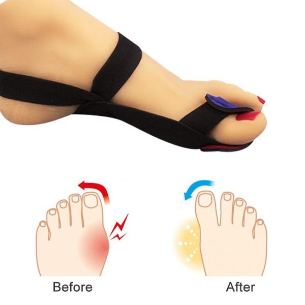 Big Toe Corrector Toes Separator